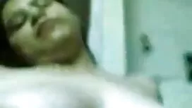 কালশিটে দাগ সেক্সি ভ ...
