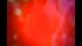 মেয়ে হিজড়া, মেয়েদ ...